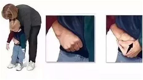 寶寶誤吞異物，怎么緊急處理！