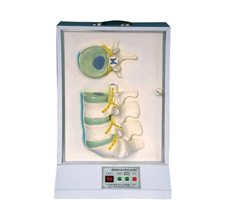 腰骶椎、椎間盤和脊神經電動模型